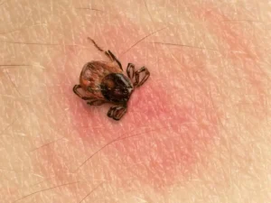 tick bites human - don't let it happen to you with tick extermination from Johnson Pest Control